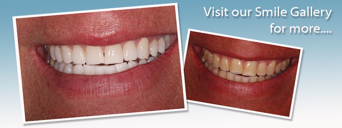 Visit Our Smile Gallery for more!
